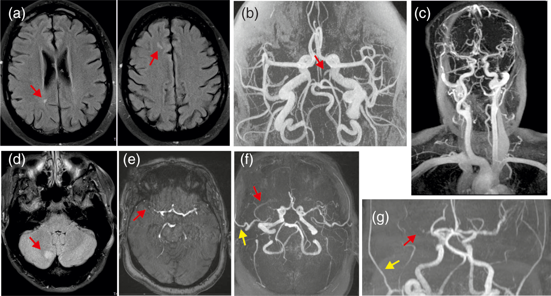 FIGURE 6