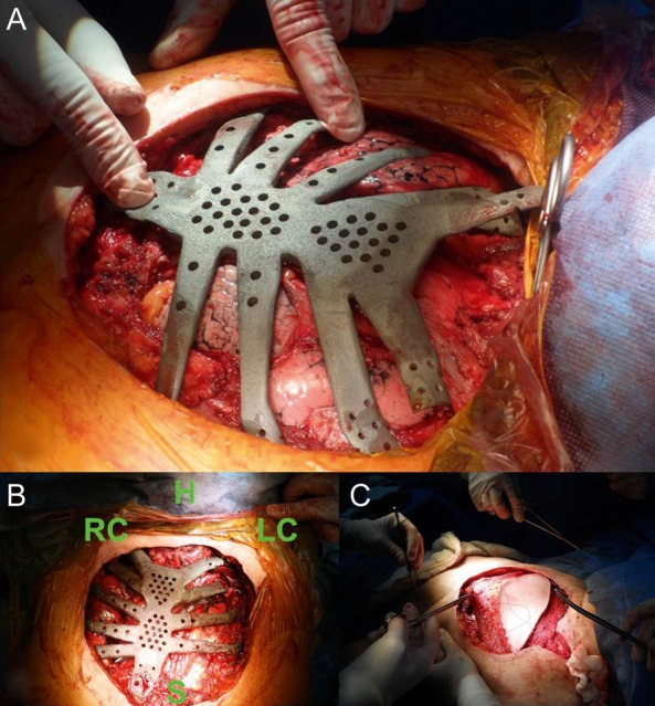 Figure 2: