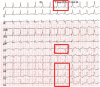 Figure 6B: