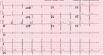 Figure 6A:
