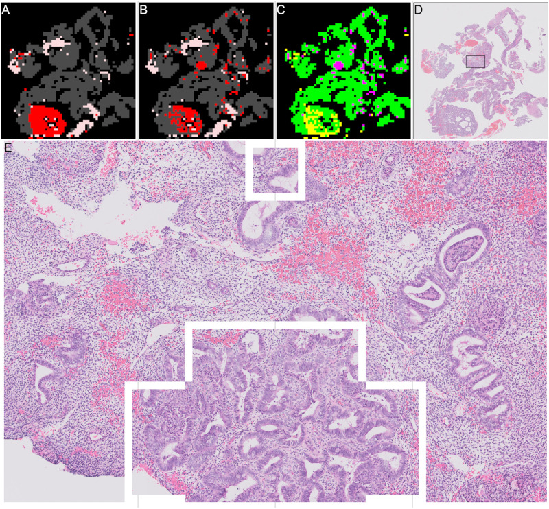 Fig 14