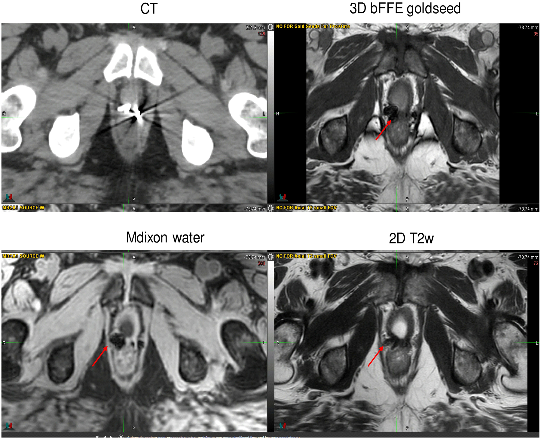 Figure 4: