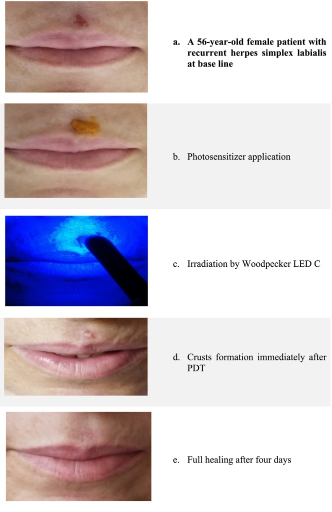 FIGURE 1