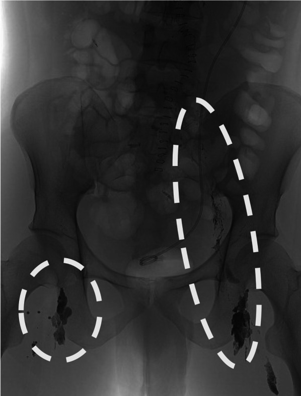 Fig. 3