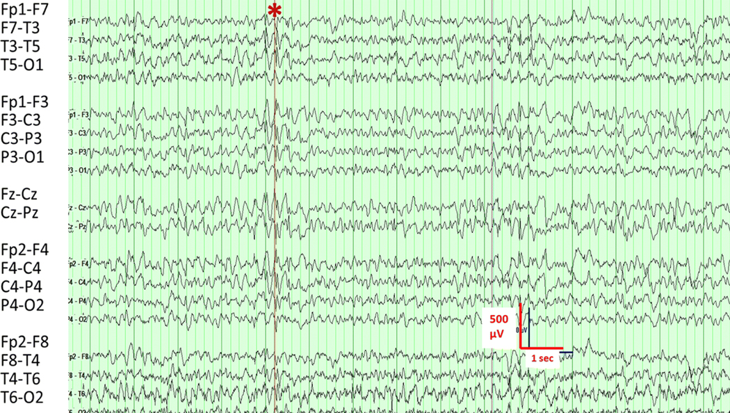 Fig. 3.