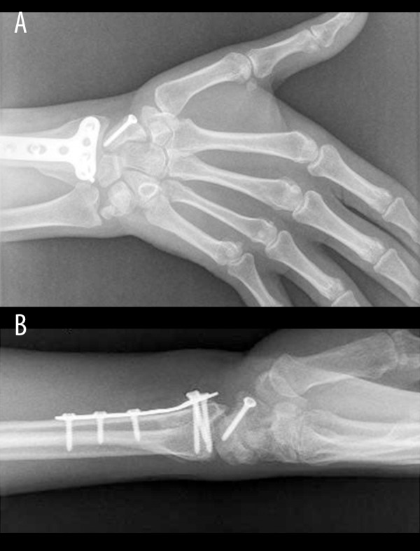 Figure 6.