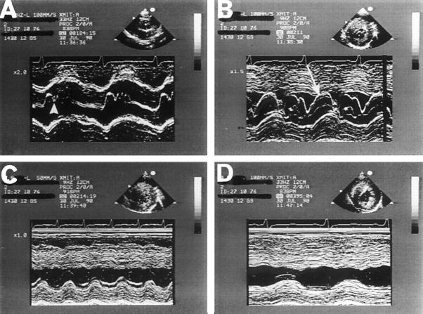 Figure 1  