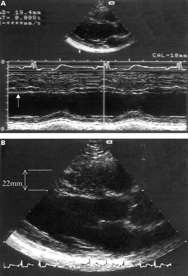 Figure 6  