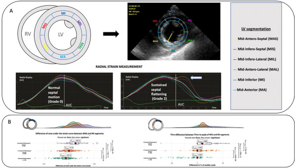 Figure 1 (abstract FC-003)