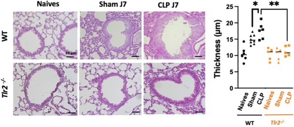 Figure 1 (abstract FC-255)