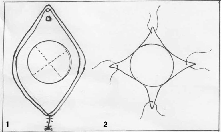 Fig. 1