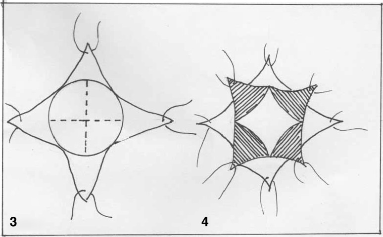 Fig. 2