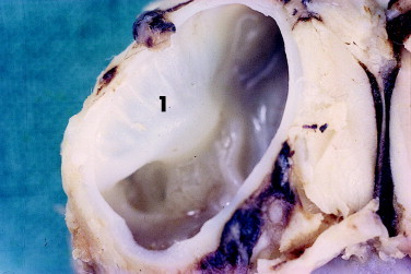 Figure 12-7