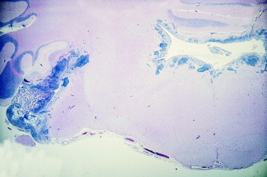 Figure 12-23