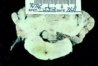Figure 12-25