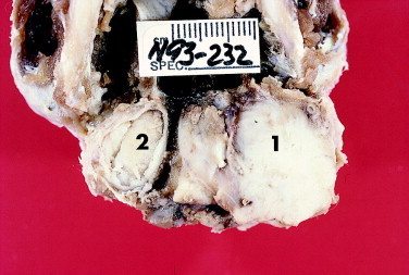 Figure 12-17