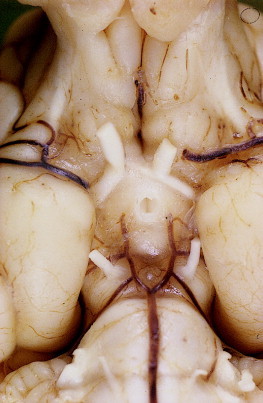 Figure 12-28
