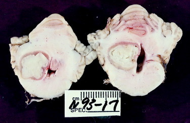 Figure 12-26