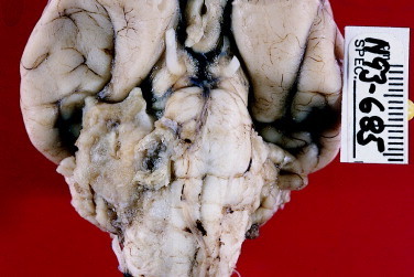 Figure 12-12