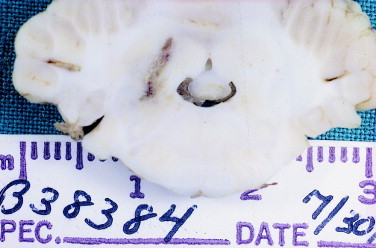 Figure 12-19