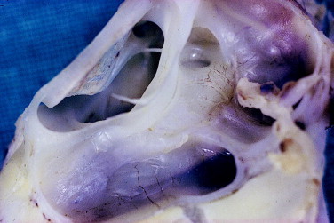 Figure 12-8