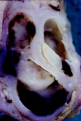 Figure 12-9