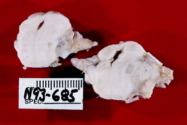 Figure 12-14