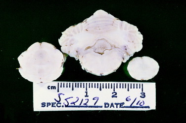 Figure 12-22
