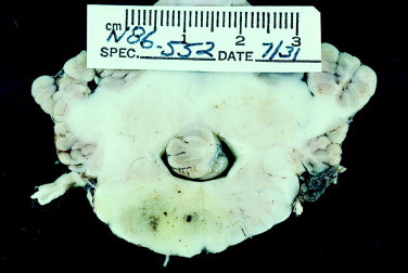 Figure 12-24