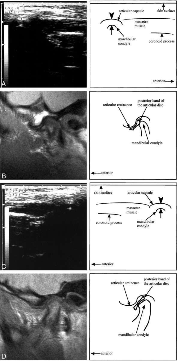 fig 3.