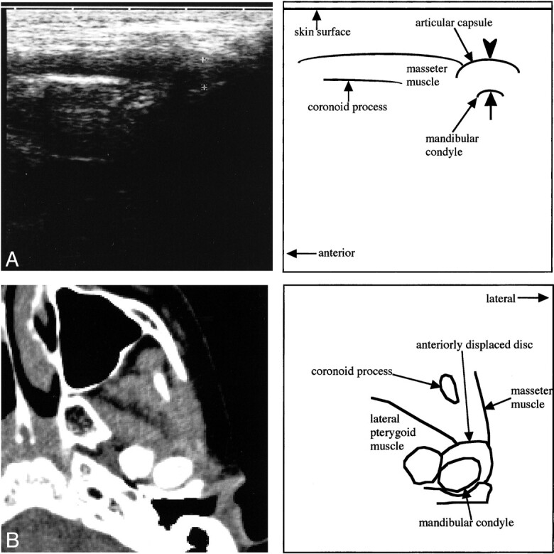 fig 5.