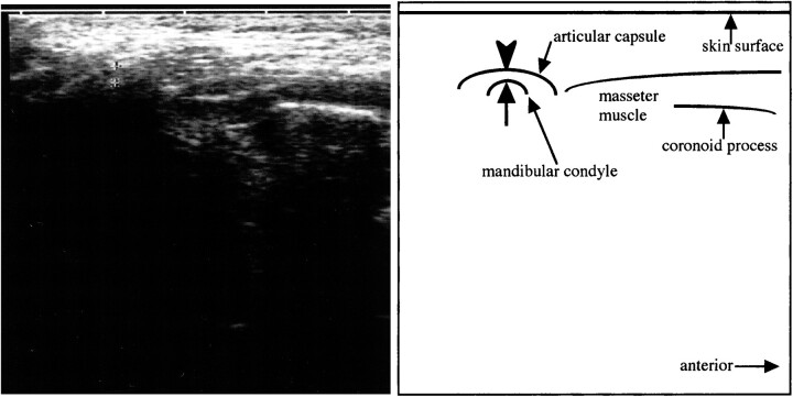 fig 2.