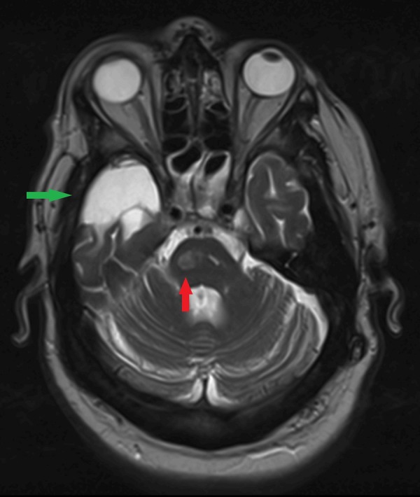 Figure 2