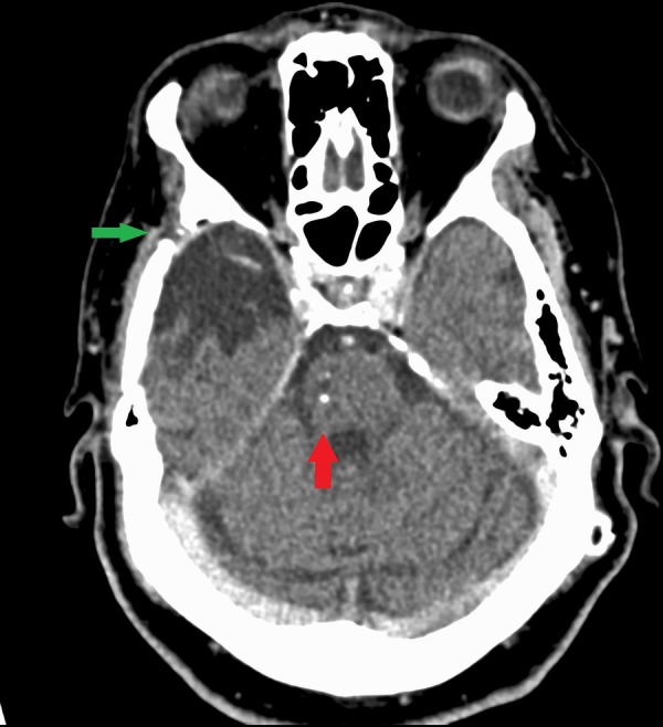 Figure 1