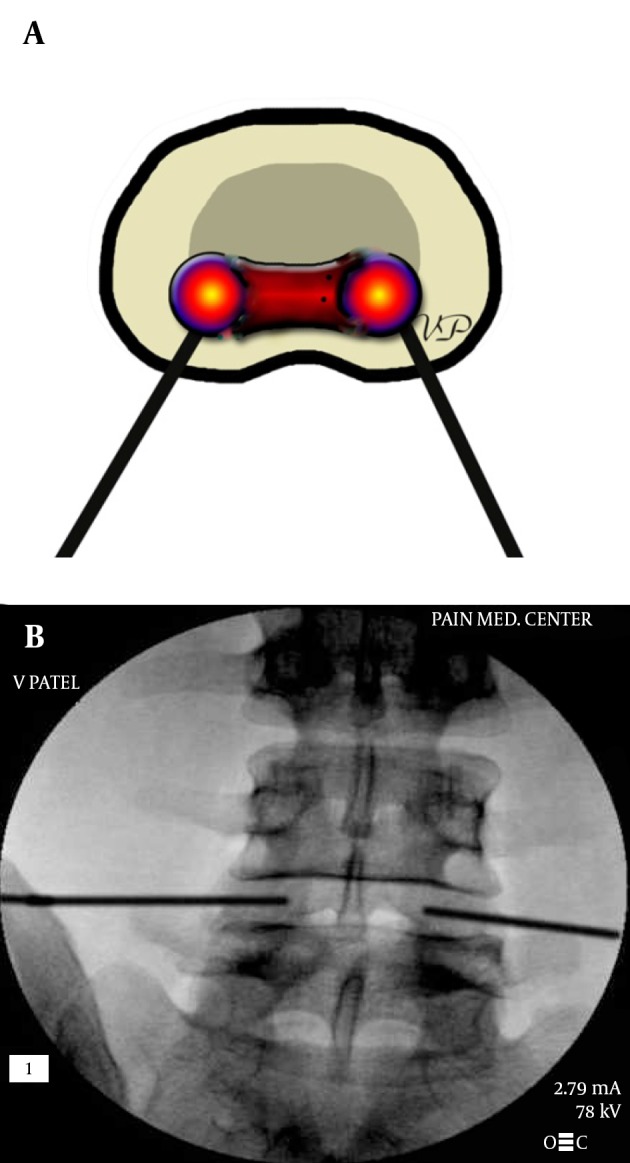 Figure 23.