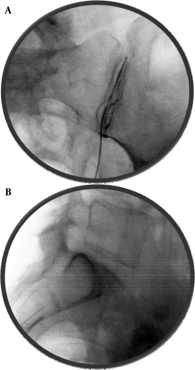 Figure 13.