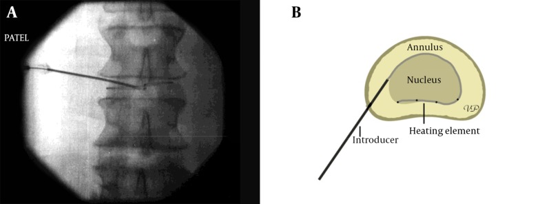 Figure 22.