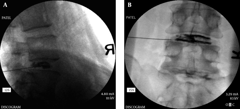 Figure 19.