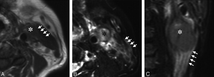 Fig 1.