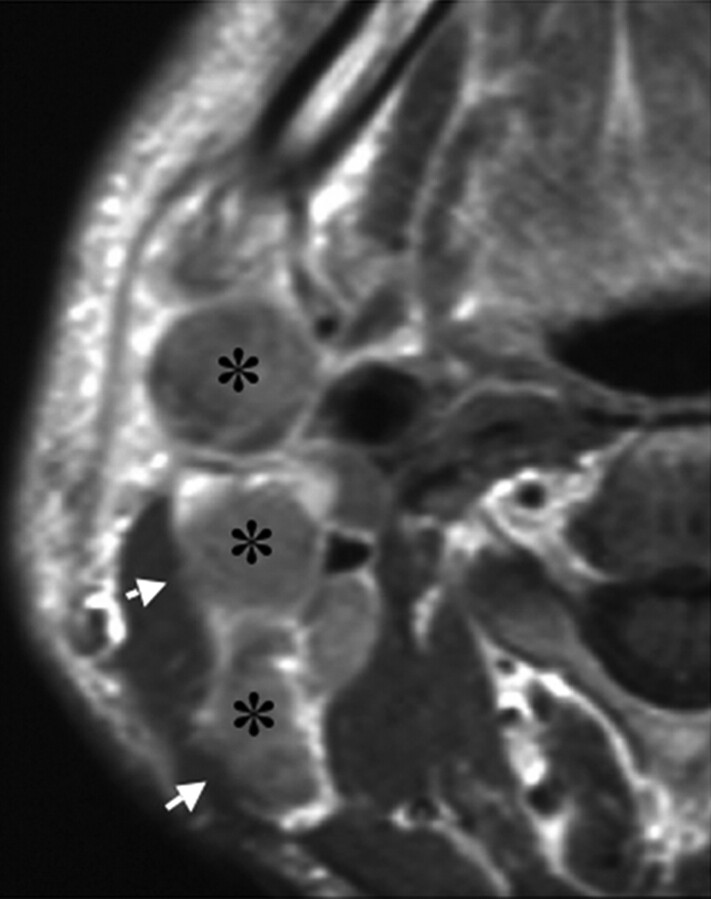 Fig 2.