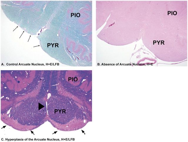 FIGURE 11.