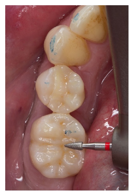 Figure 13