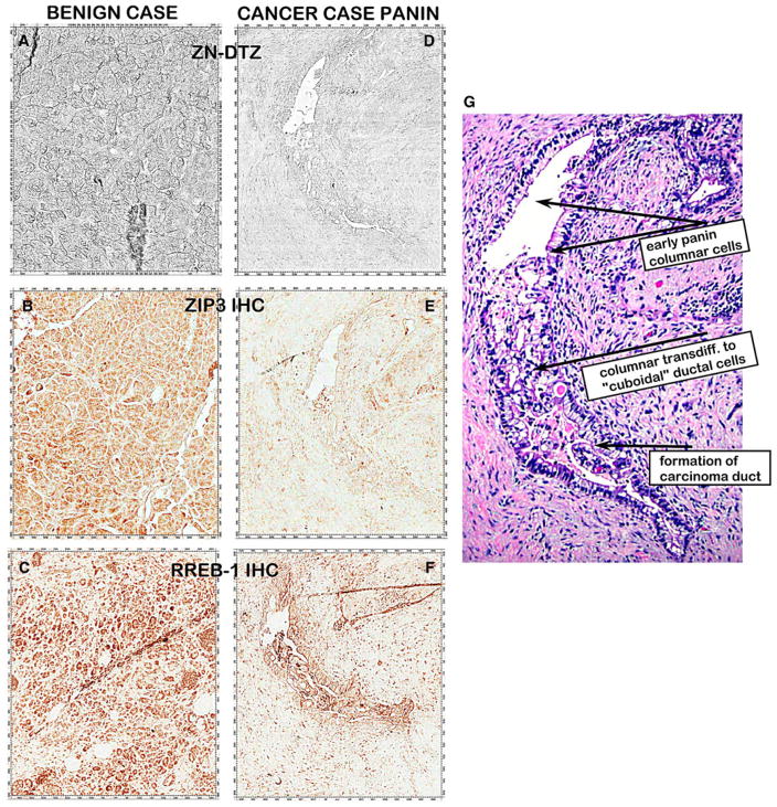 Fig. 11