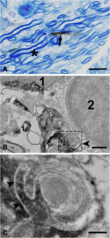 Fig. 11