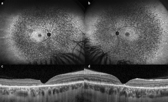 Fig. 1