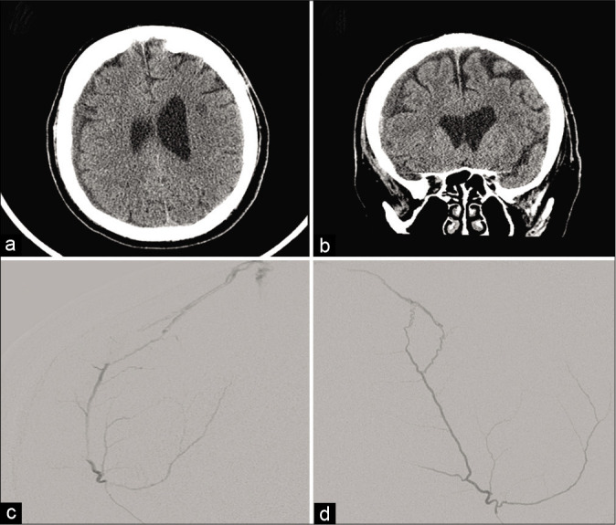 Figure 1: