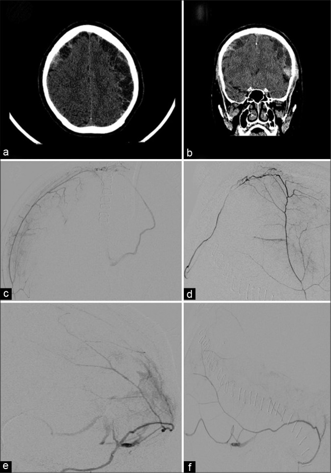 Figure 2: