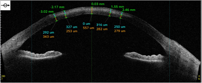 Fig. 3