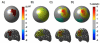 Fig. 12