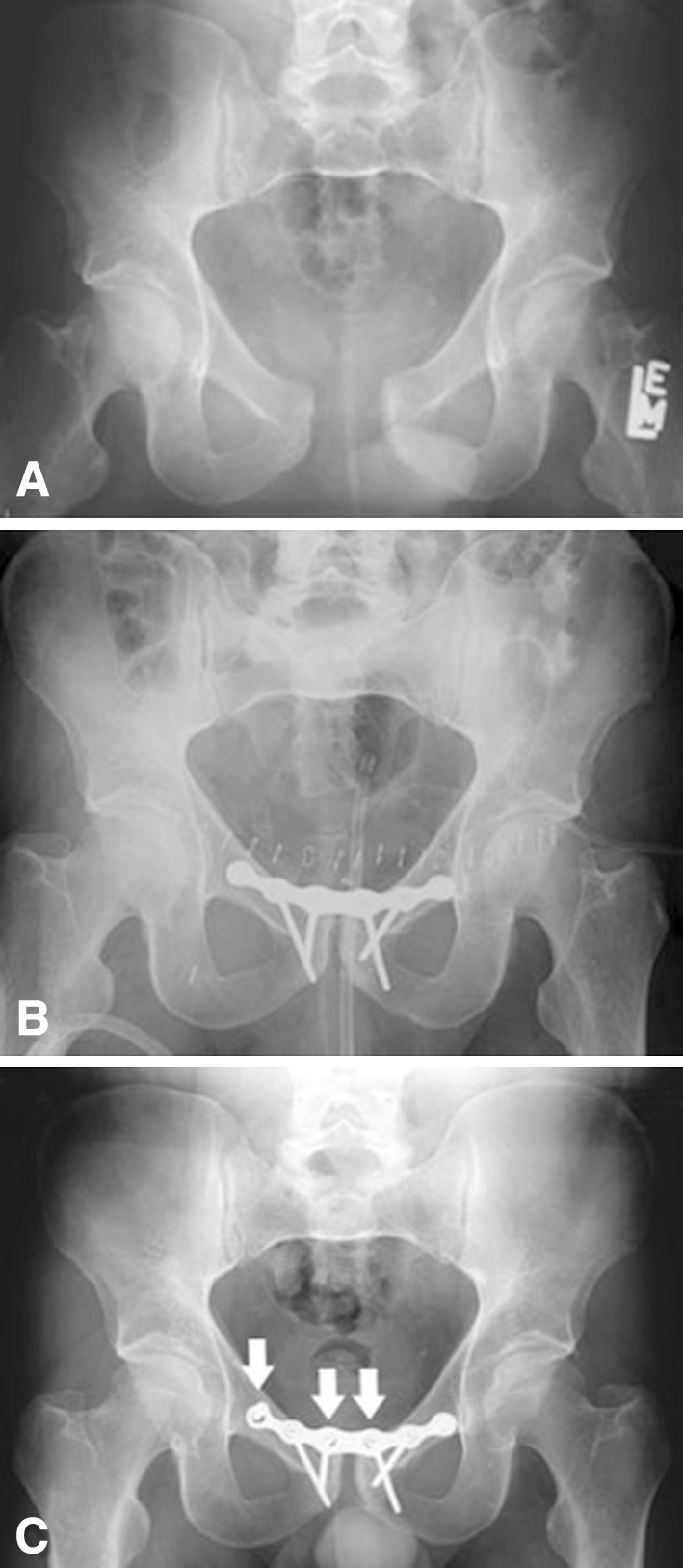 Fig. 1A–C